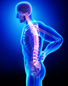 x-ray image of person standing and holding back in pain